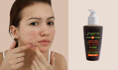 Pattanások nélkül: JimJams CLEAN & MATT Fekete szappan
