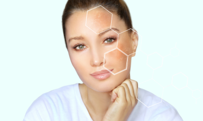 Vegyes bőr ápolása