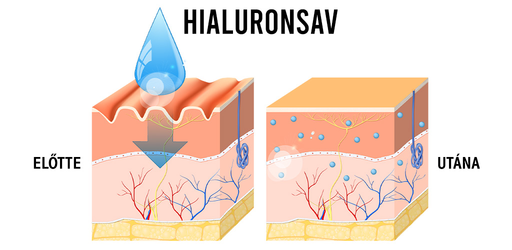 Mi az a hialuronsav?